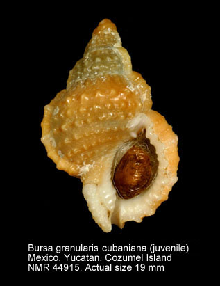 Bursa%20granularis%20cubaniana.jpg